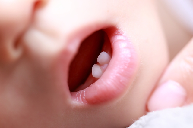 指しゃぶり 爪噛み 歯並びが悪くなる要因は くせ にあった 赤ちゃんの口腔環境 後編 ミキハウス 妊娠 出産 子育てマガジン