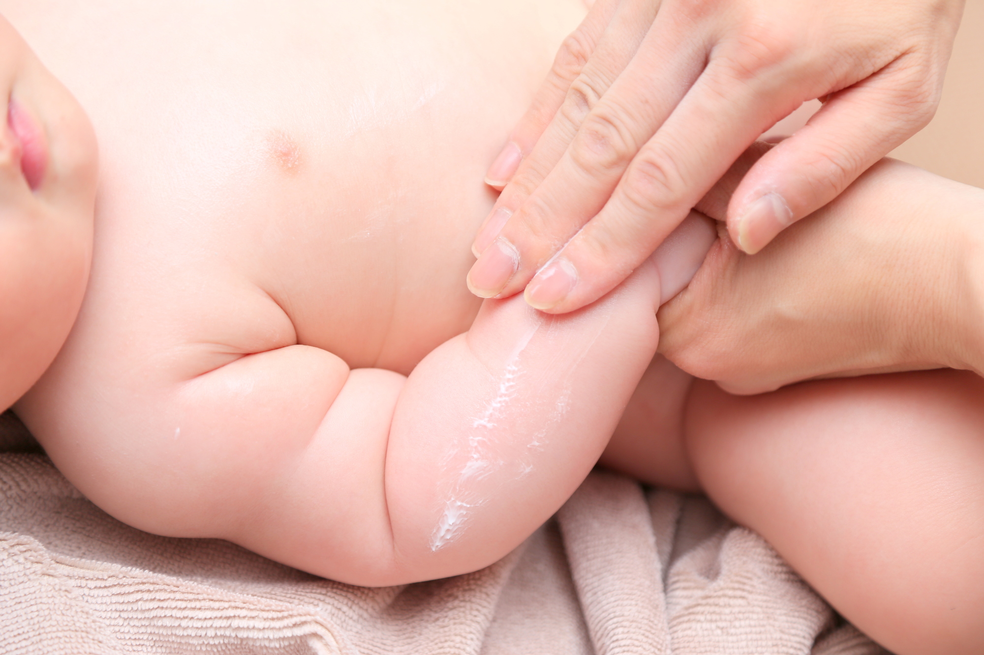 生後1か月、2か月でもアトピー性皮膚炎になっている？