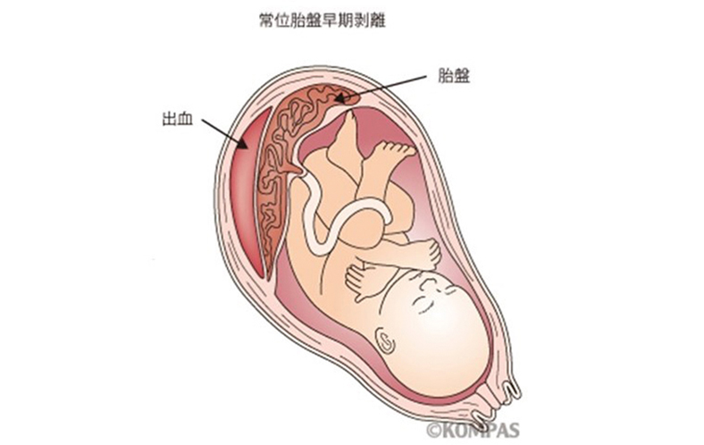 〈慶應義塾大学病院KOMPASより転載〉