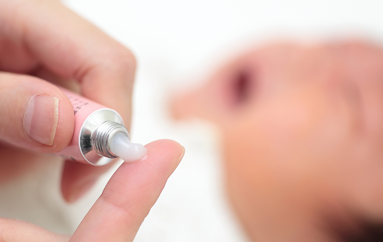 乳児湿疹とアトピー性皮膚炎の違いは？